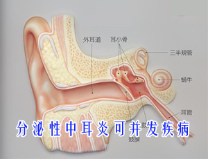 小孩患中耳炎的癥狀有哪些